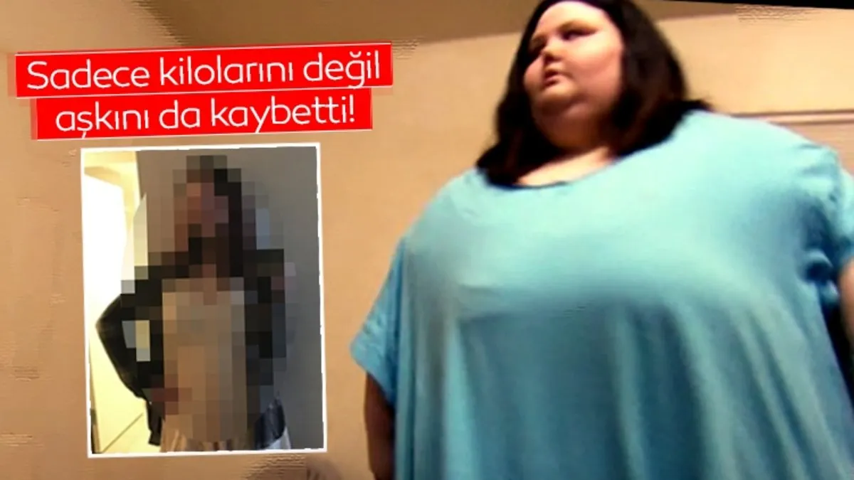 Kilolarıyla birlikte aşkını da kaybetti! 181 kilo verdi kocası tarafından terk edildi…